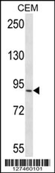 RRP1B Antibody (N-term)