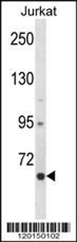 CRTC2 Antibody (N-term)