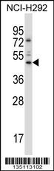 TEAD3 Antibody (N-term)