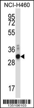ZFPL1 Antibody (Center)