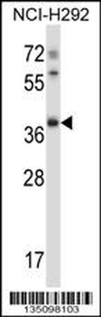 Mouse Tssk6 Antibody (C-term)
