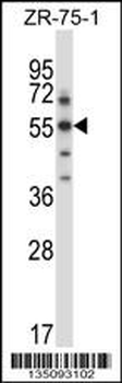 Mouse Sgk3 Antibody (C-term)