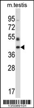 Mouse Sgk196 Antibody (C-term)