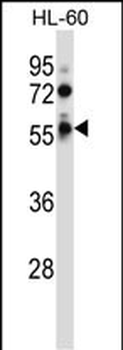 FKRP Antibody (Center)