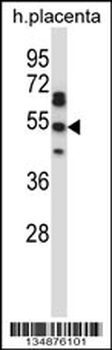 TEAD2 Antibody (Center)
