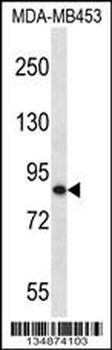 OTU7B Antibody (C-term)