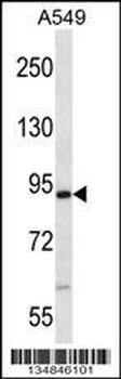 Mouse Nek4 Antibody (N-term)