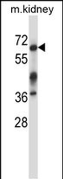 Mouse Irak3 Antibody (C-term)