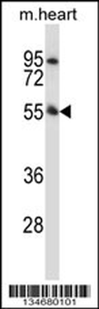 Mouse Pink1 Antibody (N-term)