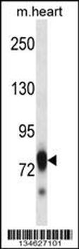 Mouse Scyl3 Antibody (C-term)