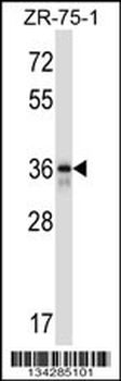 FETUB Antibody (C-term)