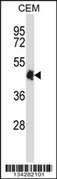 CREB5 Antibody (N-term)
