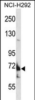 TMC8 Antibody (N-term)