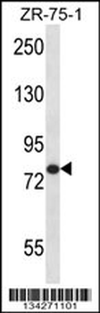 AGGF1 Antibody (N-term)