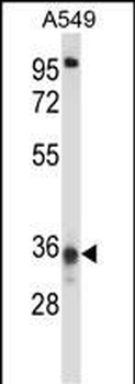 CCDC50 Antibody (Center)