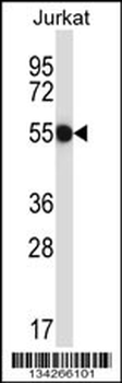 CNOT2 Antibody (Center)