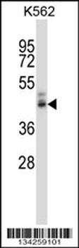 PPYR1 Antibody (N-term)