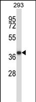 MOAP1 Antibody (N-term)