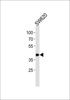 HDBP1 Antibody (Center)