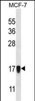 NDUFA13 Antibody (N-term)
