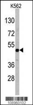 DRAGON (RGMB) Antibody (Center)