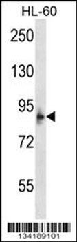 MCPH1 Antibody (N-term)