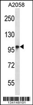 TMC6 Antibody (N-term)