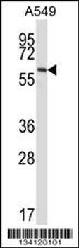 FZD5 Antibody (C-term)