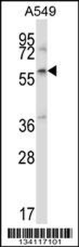 ZBTB7A Antibody (C-term)