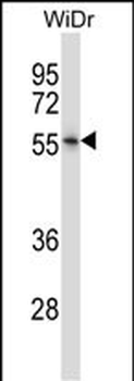 NR2E3 Antibody (Center)