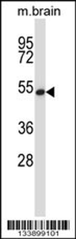 GTF2H1 Antibody (N-term)