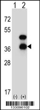 CD72 Antibody (Center)