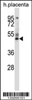 GRAMD3 Antibody (N-term )