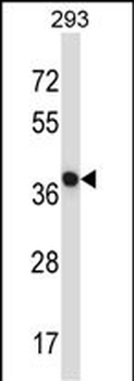 NECAB1 Antibody (Center)