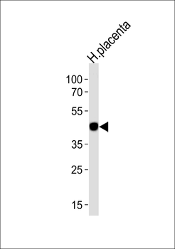 CIR Antibody (C-term)