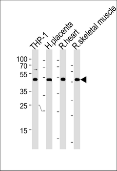 CIR Antibody (N-term)