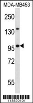 NUP88 Antibody (C-term)
