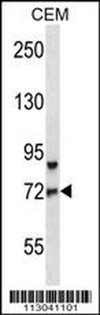 FOXO3 Antibody (Center)