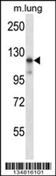 Mouse Map3k14 Antibody (C-term)