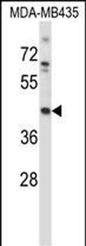Mouse Map2k1 Antibody (C-term)