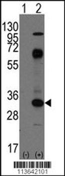 CD8A Antibody (C-term)
