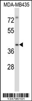 Mouse Irak4 Antibody (C-term)