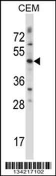 WNT3 Antibody (Center)