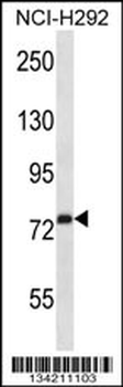 RPH3A Antibody (C-term)
