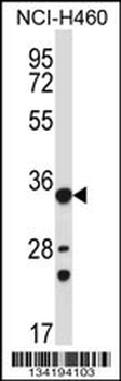 AKR1B10 Antibody (Center)