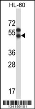 APLNR Antibody (Center)
