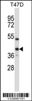 ERCC1 Antibody (C-term)