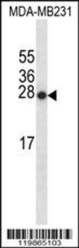 SNX24 Antibody (Center)