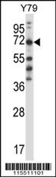 FARSB Antibody (C-term)