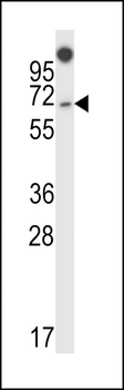 NUMBL Antibody (C-term)
